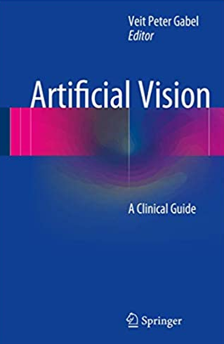 Artificial Vision: A Clinical Guide Veit Peter Gabel, ISBN-13: 978-3319418742