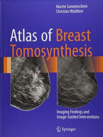 Atlas of Breast Tomosynthesis: Imaging Findings and Image-Guided Interventions, ISBN-13: 978-3319215655