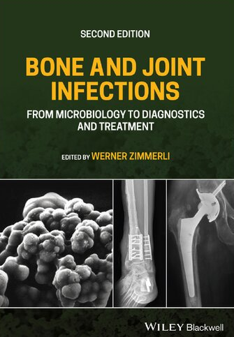 Bone and Joint Infections: From Microbiology to Diagnostics and Treatment 2nd Edition, ISBN-13: 978-1119720652