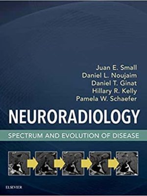 Neuroradiology: Spectrum and Evolution of Disease – eBook PDF
