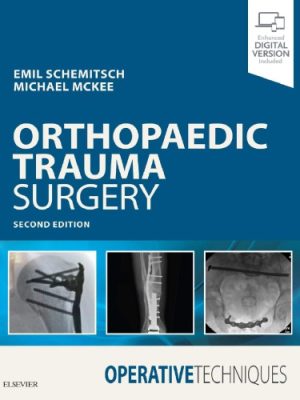 Operative Techniques: Orthopaedic Trauma Surgery (2nd Edition) – eBook